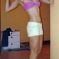 anorexia nervosa