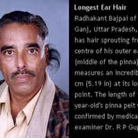 Ear hair