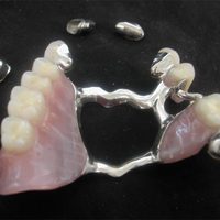 dental bridge from someone's mouth