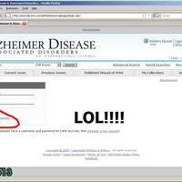 Alzheimer's disease..