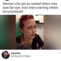 Retard