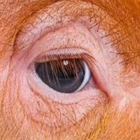 what's the deal with trumps eye?
