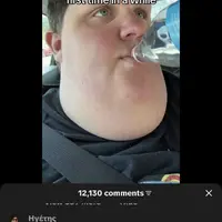 Adam's pineapple 